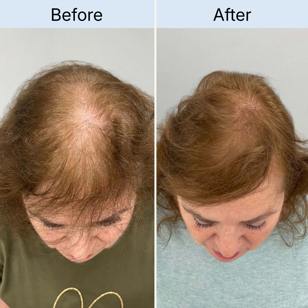 Crown / top of head