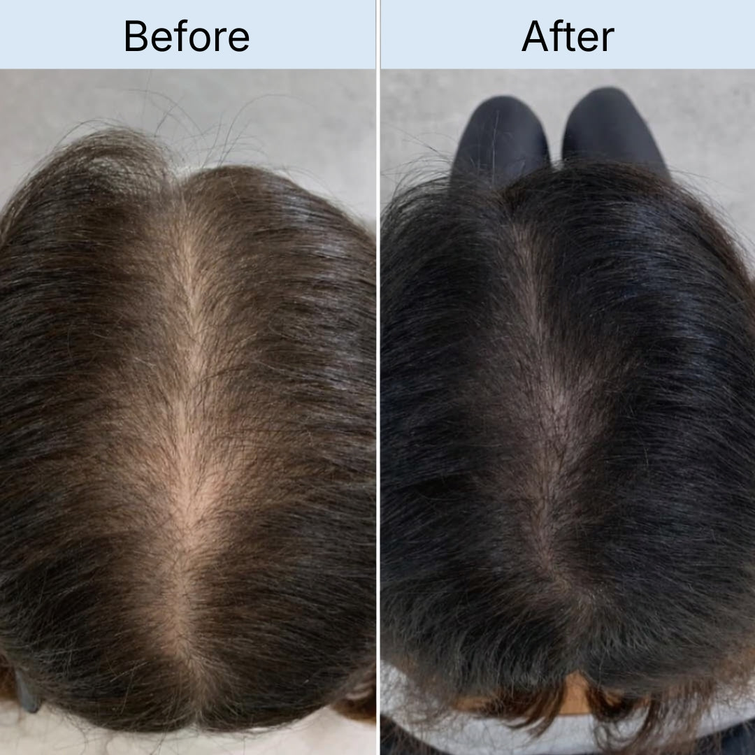 Central parting
