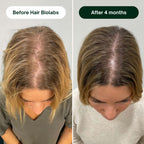Hair Biolabs - Hair Regrowth System