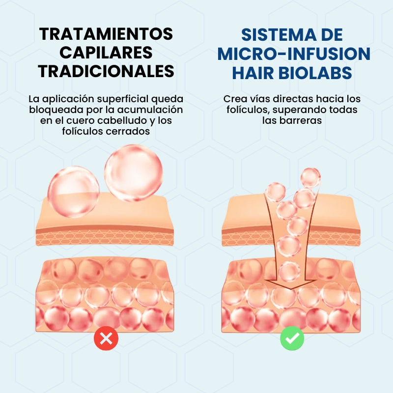 Sistema de Microinfusión Capilar de Doble Acción Hair Biolabs®