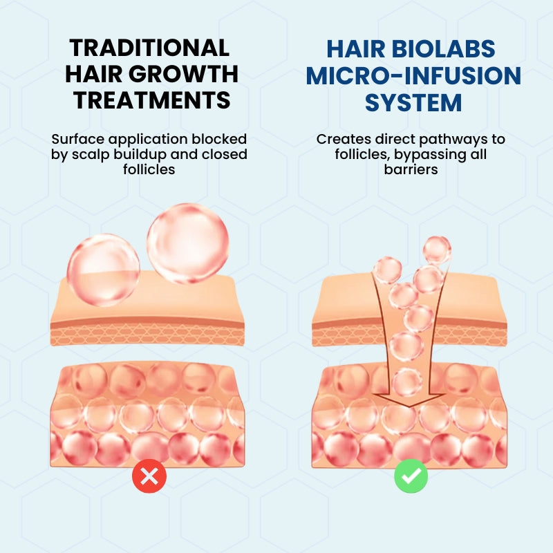 Clinical Regrowth Filler by Hair Biolabs™