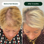 Hair Biolabs - Hair Regrowth System
