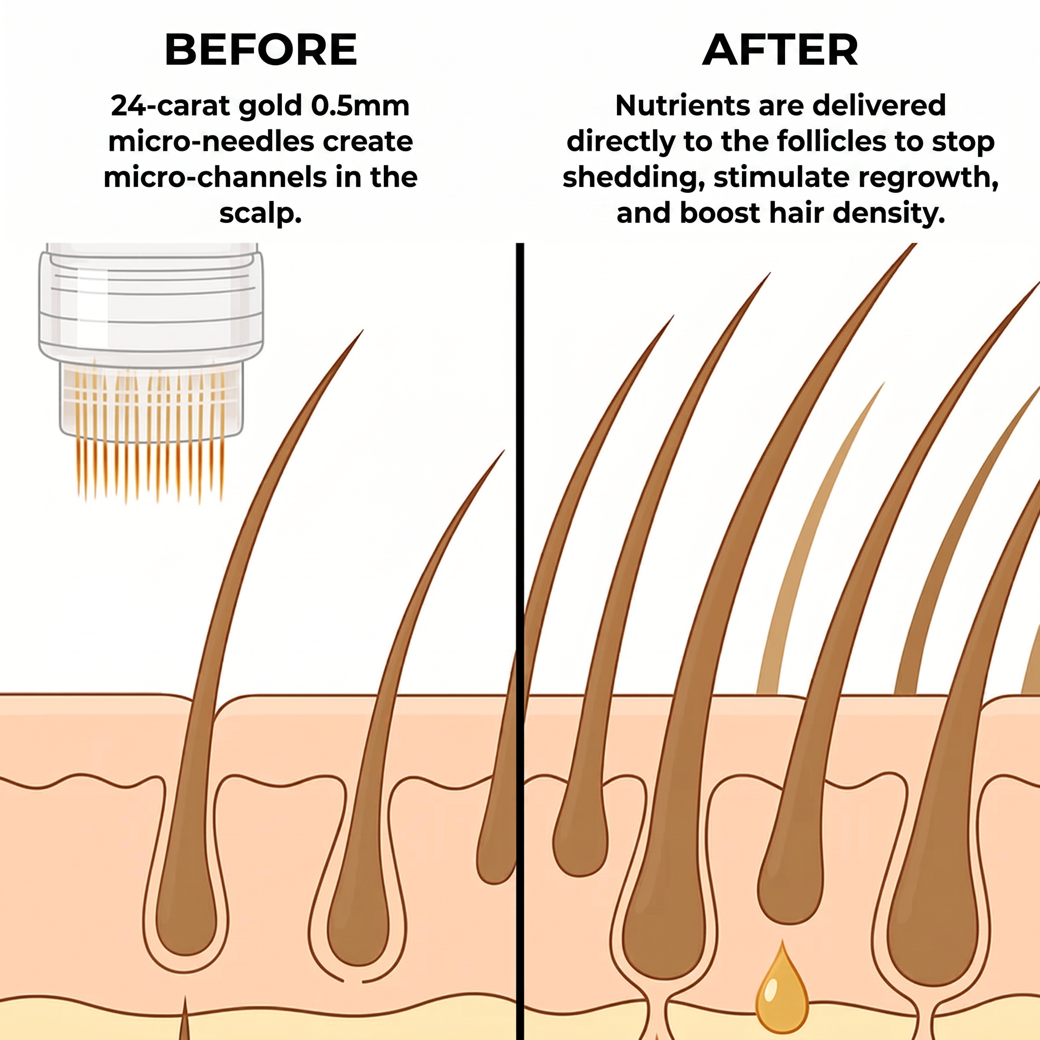Women's Micro-Infusion® Hair Technology
